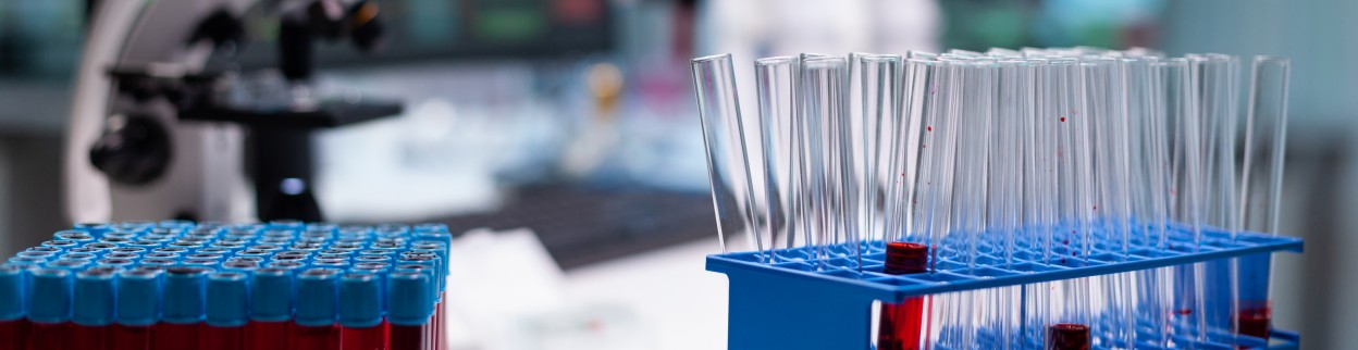 Punkt pobrań materiałów do badań