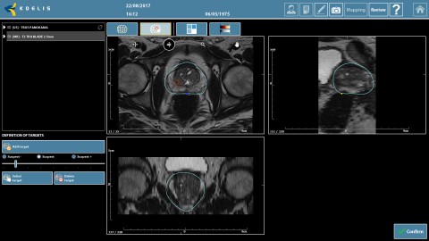 REZONANS MRI_COTOUR_TARGET